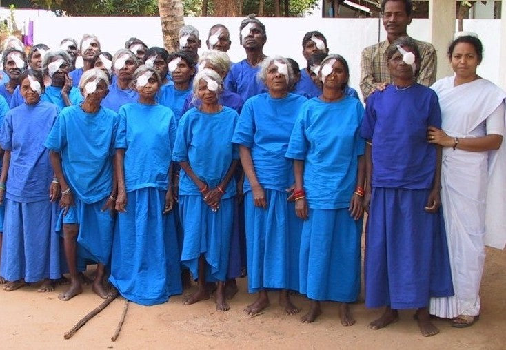 100 Cataract Eye Surgeries